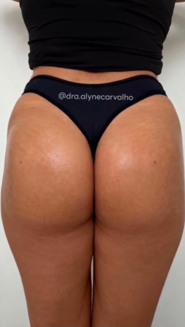 Depois do procedimento